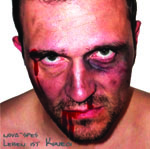 Valokuva mukiloidusta ja hyvin punertavanaamaisesta miehestä, jolla ajamaton sänki ja verta silmäkulmassa.